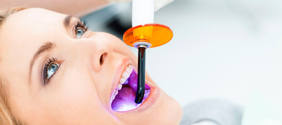 Tipos y tratamientos de blanqueamiento dental