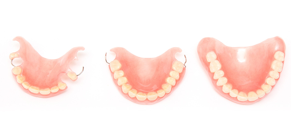 protesis-dental-fija-2